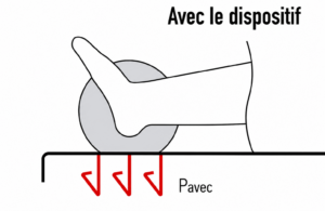 Schéma pied avec dispositif et pression au sol